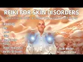 Reiki for Healing Skin Disorders Acne Eczema Psoriasis Hives Cold Sores and more
