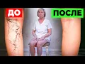 Download Lagu ПОКАЖУ КАК БЫСТРО ИЗБАВИТЬСЯ ОТ ВАРИКОЗА 1 УПРАЖНЕНИЕМ MP3