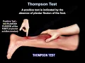 Thompson Test Achilles tendon tear