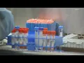 IU Health lab tests for monkeypox