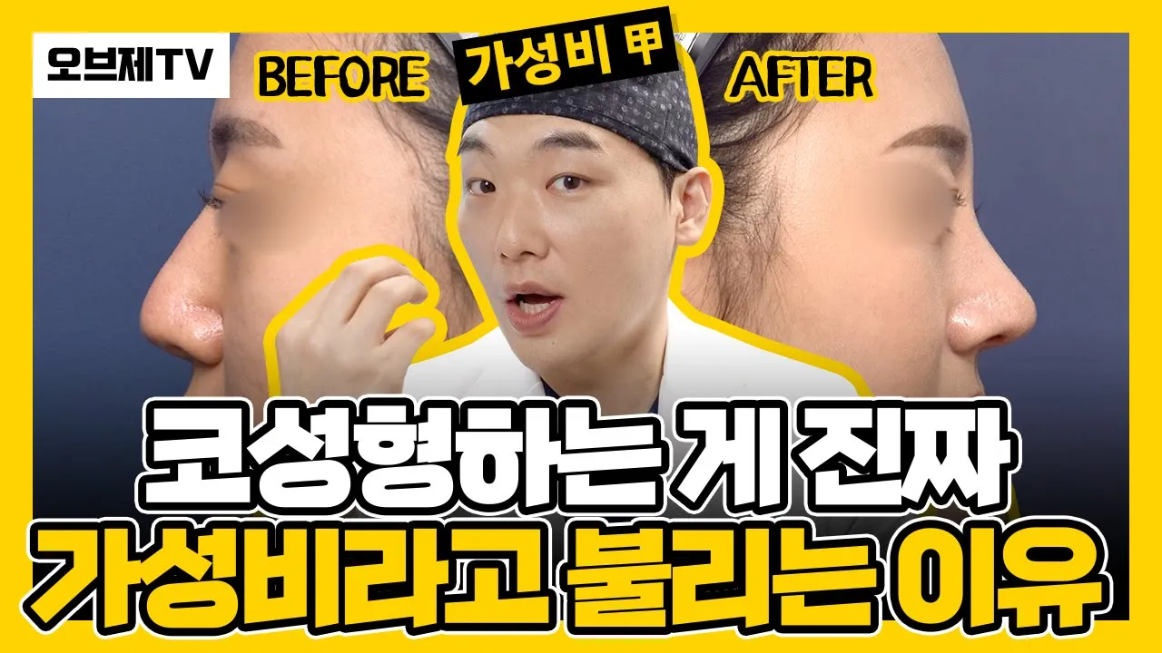코성형 이유, 진짜 여기에 있다! 코성형하는 게 진짜 가성비라고 불리는 이유 | 코부지 이경묵 원장) 코성형전후, 코성형후기, 오브제성형외과