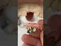 Flexi Partial EnvisiontecMain