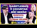 İŞARETLENMİŞ 11 ÇOCUKTAN BİRİ BENİM!Dünyaya Sakallı Olarak Geldim! | Anlatmak Zamanı 121. Bölüm