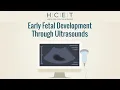 Ultrasounds and Early Fetal Development English