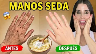 MANOS DE SEDA Y SIN MANCHAS EN 1 NOCHE! 😱 El Secreto de la Patata y el Bicarbonato ✨