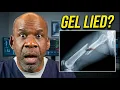 Surgeon Reacts Garand Thumb s 5 56 Test Missed The Most Important Part