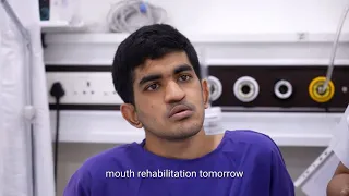 Deformed Nose Corrected by Expert Surgeon India