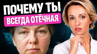 Откажитесь от этих 6 привычек, чтобы перестать отекать // Как убрать отеки?
