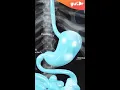 Download Lagu This Is What Happens During Vomiting | 3D #Shorts
