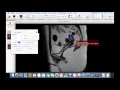 9 How to Annotate Studies in Osirix