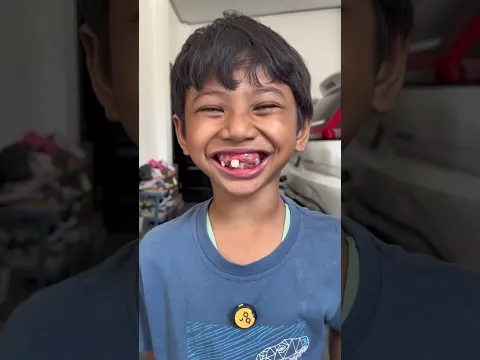 jangan kebanyakan makan coklat nanti gigi nya ompong