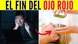 Hábito Para Evitar La PÉRDIDA DE VISIÓN (Y Frenar 5 Enfermedades Oculares)