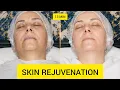 13-Minute Facial Treatment Deep Cleansing Skin Rejuvenation