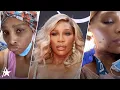 Serena Williams Had Grapefruit-Sized Cyst Removed From Neck