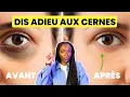 Download Lagu POURQUOI tu as des CERNES (et comment les identifier)