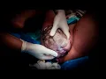Lagu OMG 😱 NATURAL BIRTH LIVE 2026 | The Moment Everything Changes 💗 Birth Journey