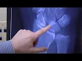 HealthBreak - Dignity Health Urgent Care Centers