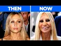 45 Celebrities Before After Plastic Surgery Then vs Now