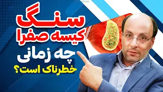آیا سنگ کیسه صفرا خطرناک است  دندنها