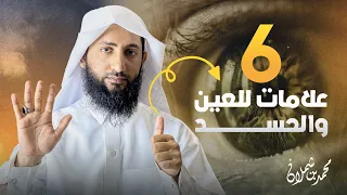 علامات العين والحسد دندنها