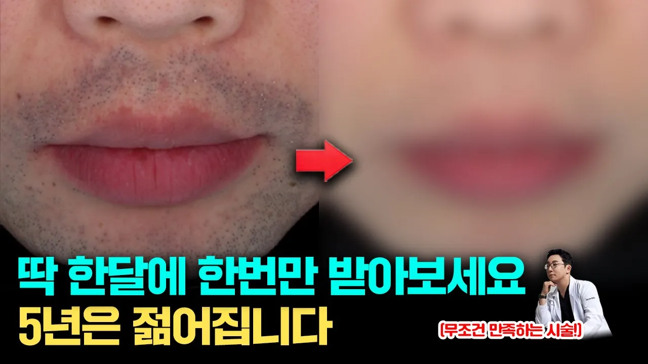 털도 없어지고 피부도 좋아지는 레이저 제모의 숨겨진 효과 / 남자 피부 관리의 첫 걸음 젠틀맥스프로