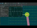 Simphy Tutorials Fields Forces controllers Best Simulation Software