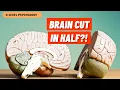 Hemispheric Lateralisation Split-Brain Research Biopsychology AQA Psychology