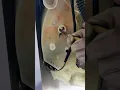 Cabrio Whirlpool washer drain plug removal