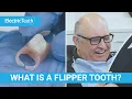 What is a flipper tooth