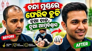 ଚନ୍ଦା ମୁଣ୍ଡରେ ଫେରିବ ଚୁଟି || Best Hair Transplantin & treatment Balasore Soro | Best Result odia