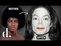 Download Lagu Hoeveel plastische chirurgie heeft Michael Jackson eigenlijk gehad? UPDATE 2021 | the detail.