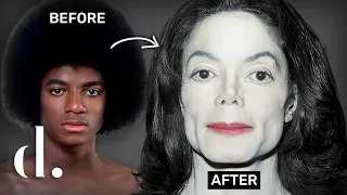 How Much Plastic Surgery Did Michael Jackson Actually Have NEW DETAILS the detail