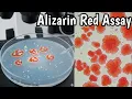 Alizarin Red Assay Detect Quantify calcium deposits in cell cultures