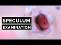 Download Lagu Speculum Examination | Vagina | OSCE Guide | UKMLA | CPSA | PLAB 2