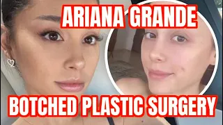 Download Ariana Grande Plastic Surgery Drama MP3