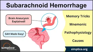 Subarachnoid Hemorrhage - Mnemonic, Causes, Pathophysiology [Brain Aneurysm] #nursing