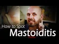 Do I have Mastoiditis Bone Infection behind the Ear