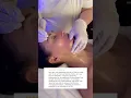 Bells palsy - Buccal massage expert Houston