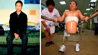 Lembra do homem que foi DIVIDID0 ao meio? Ele se RECUPEROU e está PROSPERANDO