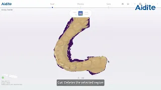 3 Aidite Rapid 3 Intraoral Scanner Restoration Scan