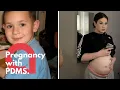 A teen born with male genitalia is pregnant after finding she has working ovaries and uterus SWNS