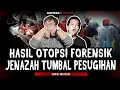 Download Lagu BEDAH JENAZAH TUMBAL PESUGIHAN?! BIKIN RUMAH SAKIT FORENSIK INI GEMPAR!!