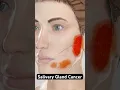 Download Lagu Cancer in your salivary glands (3D Animation)