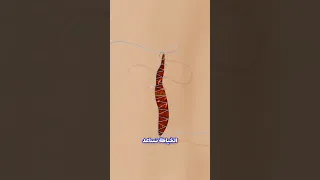 ماذا يحدث لجسمك أثناء خياطة الجروح  اكتشف العملية المدهشة  دندنها