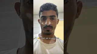 الصنفرة اسوء شي ممكن تتخيله 