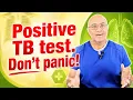Positive TB Blood Test Don t Panic Here s What It Really Means