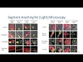 VIA Webinar Segment Anything for Microscopy with Prof Constantin Pape