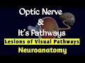 NEUROANATOMY LESIONS OF VISUAL PATHWAYS