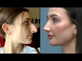 Woman Says She Saved 11 000 Over 10 Years for Nose Job
