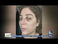 Only on 8 Woman said random group attacked her on Las Vegas Strip follows recent area crime